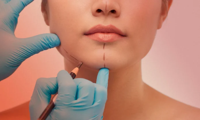 ¿Ahora los servicios públicos realizarán servicio de cirugía estética?