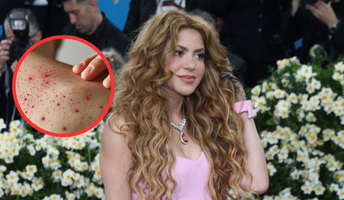 https://eltecolote.mx/2025/05/investigan-posible-exposicion-masiva-a-sarampion-durante-concierto-de-shakira-en-nueva-jersey-el-tecolote-diario/